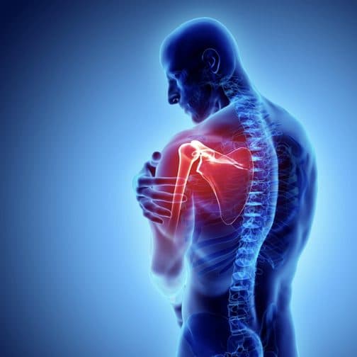 Poor Joint Health Linked With Reading Articles About Joint Health